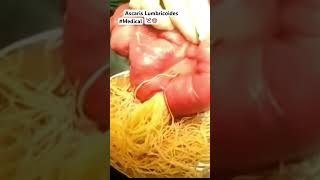 Ascaris Lumbricoides Parasito 🙊 shorts information content [upl. by Harbison]