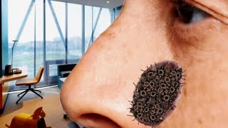 What happened to the infected nose animation Treating the nose using ASMR removing the larvae [upl. by Nomde]