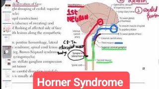 Horner Syndrome Causes Symptoms amp Treatment ophthalmology 26  First Aid USMLE Step 1 [upl. by Menides]