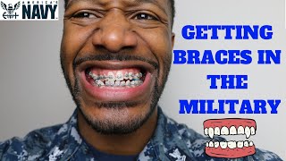 How to get Braces in the Military [upl. by Cohla]