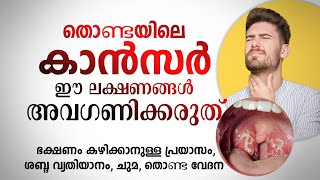 തൊണ്ടയിലെ കാൻസർ ഈ ലക്ഷണങ്ങൾ അവഗണിക്കരുത്  Throat Cancer [upl. by Arsi]