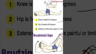 Kerning sign👨‍⚕  Brudzinski sign Sign of meningitis meningitis kerningsign viralvideo 🔥 [upl. by Eneluqcaj]