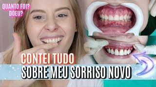 AUMENTEI MEUS DENTES doeu qual valor E MUITO MAIS [upl. by Avrom]