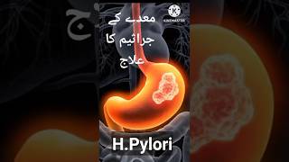 HPylori Helicobacter Pylori Signs Symptoms Lab Test and Treatment hpylori treatment shorts [upl. by Ivanna987]