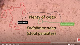 ParasitologyEndolomax E nana in stool sample under the microscope [upl. by Neelrahc]