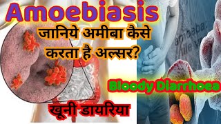 Amoebiasis pathogenesis laboratory diagnosis and treatment in hindi [upl. by Leshia]