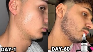 60 days beard time lapse  Day 1 to day 60  growing a beard for 60 Days  man matters beard oil [upl. by Anilac956]