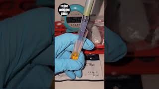 🦟Te Enseño Como Hacer la Prueba RAPIDA para Diagnostico de Antígeno del Dengue NS1 Tutorial ❤️ P1 [upl. by Fadden]