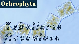 Tabellaria flocculosa Bacillariophyceae or Diatoms [upl. by Tarra]