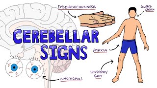 Cerebellar Dysfunction Signs Mnemonic  DANISH What are the Signs of Cerebellar Dysfunction [upl. by Josefa211]