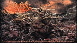 FULL ALBUM Postcoital Ulceration  Continuation of Defective Existence After Multiple [upl. by Graniela]