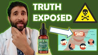 Dentitox Pro Reviews  🔴 My Honest Dentitox Pro Supplement Review 2022 🔴  Dentitox Pro Review [upl. by Thacher933]