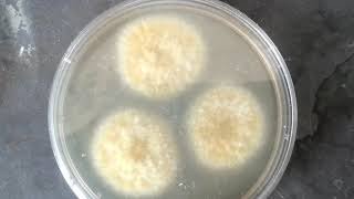 Aspergillus flavus isolation from the clinical specimen KOH mount Colony morphology LPCB mount [upl. by Dominy617]