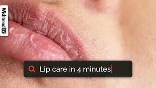 How To Get Rid Of Chapped Lips  Lip Care 101  From Exfoliating To Moisturizing ✨ [upl. by Dotson902]