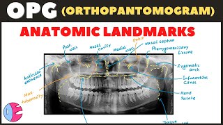 Orthopantomogram OPG Anatomical Landmarks  Panoramic Radiography landmarks  Radiology [upl. by Beale945]