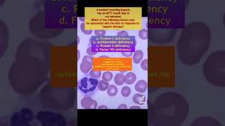 Coagulation problems Antithrombin deficiency medtechstudent medtech shortvideos foryouシ [upl. by Dennison365]