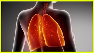 Cómo mejorar naturalmente la fibrosis pulmonar [upl. by Yrak]