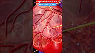 Is ejection fraction 100 l क्या ejection fraction 100 होता है l shorts [upl. by Marvin]