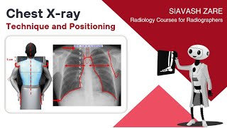 Chest Xray PA Technique and Positioning [upl. by Anrol543]