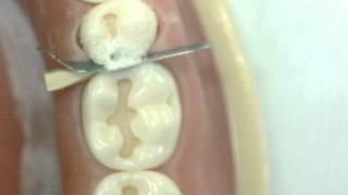 Cl II Cavity preparation Lower 2nd Premolar GV Black Dr Ahmed Sleibi [upl. by Tooley]