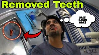 अकल दार्द वाले दांत को निकलवा दिआ  REMOVED TEETH  🥲🦷🦷 [upl. by Ailb]