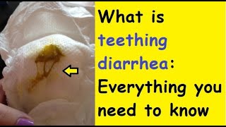 What is teething diarrhoea Everything you need to know [upl. by Main449]