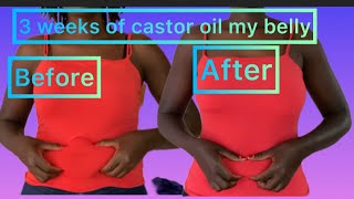 Castor oil to reduce belly fat results before and after [upl. by Latimer412]