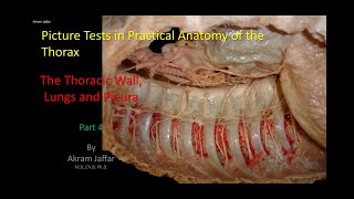 Picture Tests in Anatomy  Thorax  Wall and Lung 4 [upl. by Sido688]