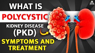 Polycystic Kidney Disease PKD ADPKD ARPKD Treatment Symptoms Causes [upl. by Anotal904]