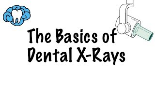 How to Read Dental XRays [upl. by Llehcram432]