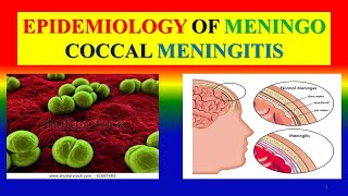 EPIDEMIOLOGY OF MENINGOCOCCAL MENINGITIS  Definition determinants pathophysiology  management [upl. by Quartis]