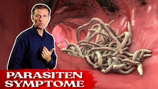 Die besten Kräuter gegen Parasiten  Parasiten Symptome  Dr Berg Deutsch [upl. by Ajnat]