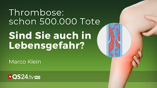 Thrombose – Prophylaxe und Behandlung  Kleinsche Felder  Marco Klein  QS24 Gesundheitsfernsehen [upl. by Peyter]