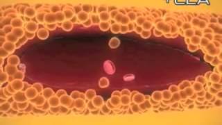 Conjugated Linoleic Acid  CLA [upl. by Kissee]