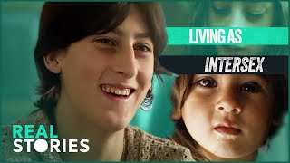 Born Intersex Defying The Binary Medical Documentary  Real Stories [upl. by Hudnut304]