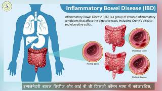 World IBD Day Subharti Hsopital worldibdday [upl. by Diego]