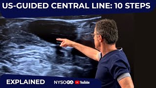 USGuided Central Line 10 Steps  Crash course with Dr Hadzic [upl. by Thorrlow600]