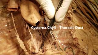 AZYGOS V THORACIC DUCT VAGUS Posterior Mediastinum and Clinical Aspects – Sanjoy Sanyal [upl. by Karyn]