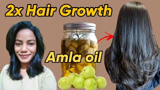 I Tried AMLA OIL for 60 Days  Before and After results 😱 [upl. by Nadnerb]