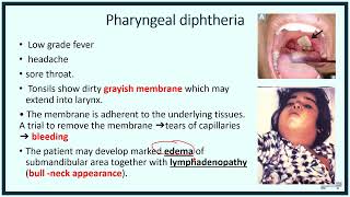 Pediatric Infectious Disease Part 5 diphtheria [upl. by Ojadnama]