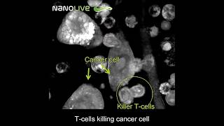 T cells killing Cancer Cell science biology [upl. by Miof Mela264]