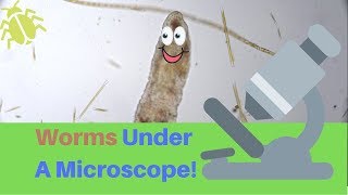 LAKE Water WORMS Under A Microscope [upl. by Thill549]