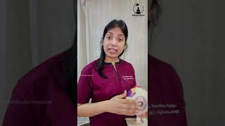 What is Pterygium  Dr Swetha Sajja  Buddhudu Hospital [upl. by Ruiz]