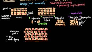 Neoplasia [upl. by Fredra94]