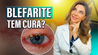 Blefarite tem Cura [upl. by Ecirual]