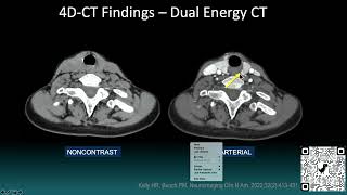 2022  Parathyroid Imaging Strategies  Hillary Kelly [upl. by Engdahl]