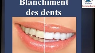 Blanchiment des dents techniques [upl. by Eisinger95]