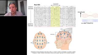 The SelfTuning Brain Normalizing Brain Oscillations with Neurofeedback [upl. by Thagard]