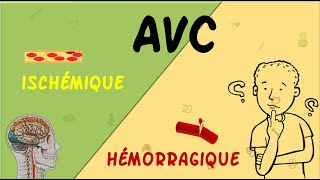 🤨AVC Hémorragique🥵 VS Ischémique🥶 Partie 12  Cours  Neurologie [upl. by Ahsot]