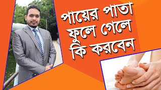 পায়ের পাতা ফুলে যাওয়ার কারণ ও ঘরোয়া চিকিৎসা Leg pain [upl. by Saixela]